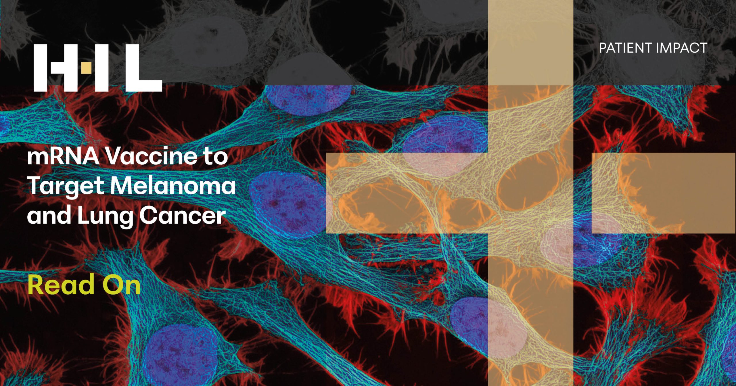 mRNA Vaccine to Target Melanoma and Lung Cancer - Health Industry Leaders