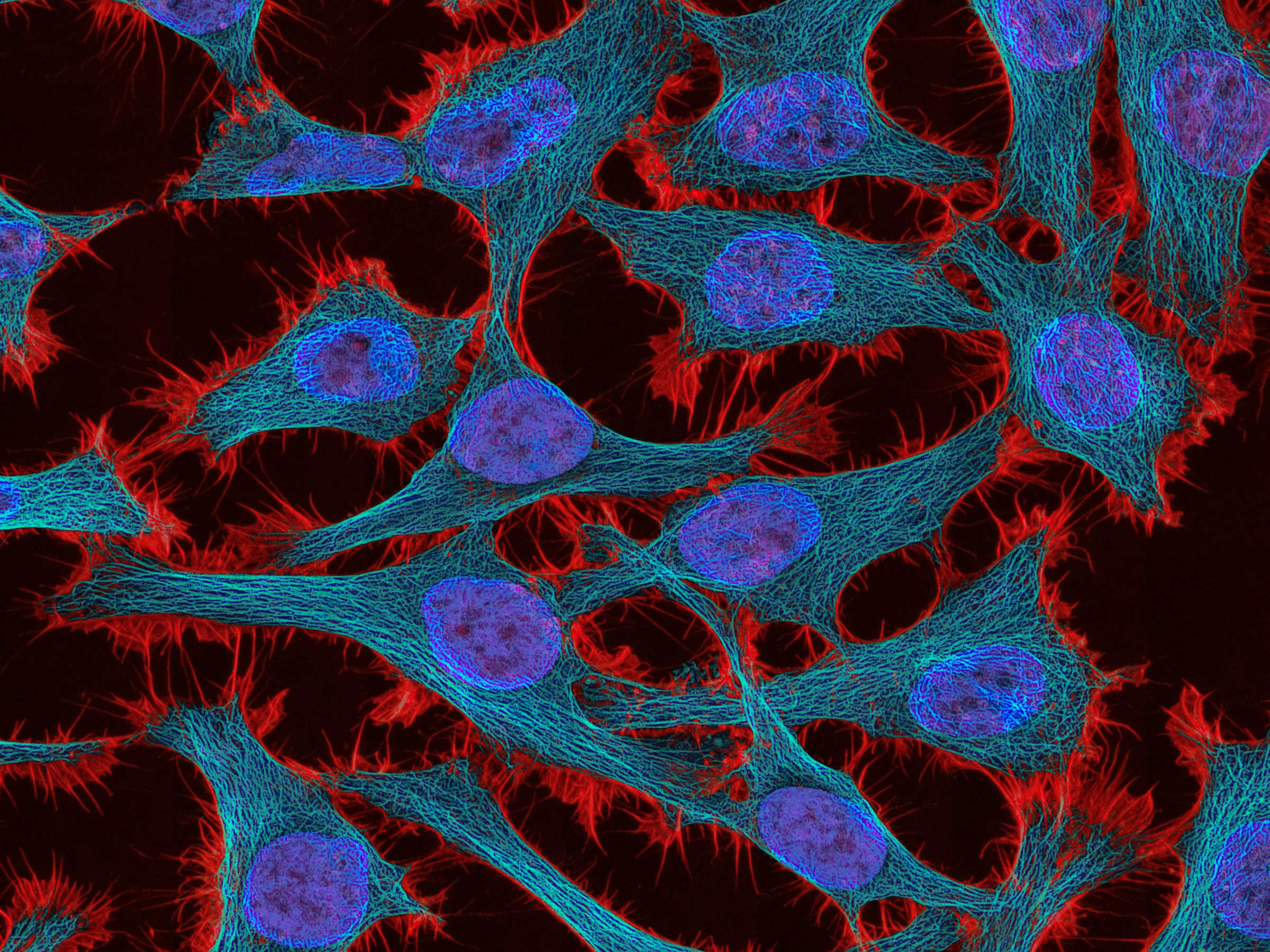 mRNA Vaccine to Target Melanoma and Lung Cancer